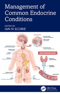 Management of Common Endocrine Conditions cover