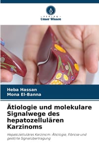 Ätiologie und molekulare Signalwege des hepatozellulären Karzinoms cover