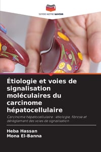 Étiologie et voies de signalisation moléculaires du carcinome hépatocellulaire cover