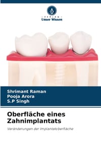 Oberfläche eines Zahnimplantats cover