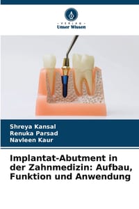 Implantat-Abutment in der Zahnmedizin: Aufbau, Funktion und Anwendung cover