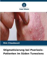 Stigmatisierung bei Psoriasis-Patienten im Süden Tunesiens cover