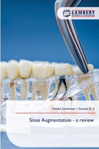Sinus Augmentation - a review cover