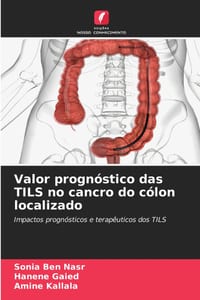 Valor prognóstico das TILS no cancro do cólon localizado cover