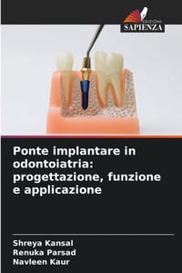 Ponte implantare in odontoiatria: progettazione, funzione e applicazione cover