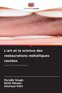 L'art et la science des restaurations métalliques coulées cover