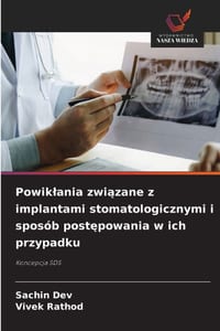 Powiklania związane z implantami stomatologicznymi i sposób postępowania w ich przypadku cover