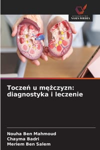 Toczeń u mężczyzn: diagnostyka i leczenie cover