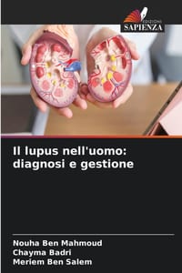 Il lupus nell'uomo: diagnosi e gestione cover