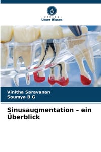 Sinusaugmentation - ein Überblick cover